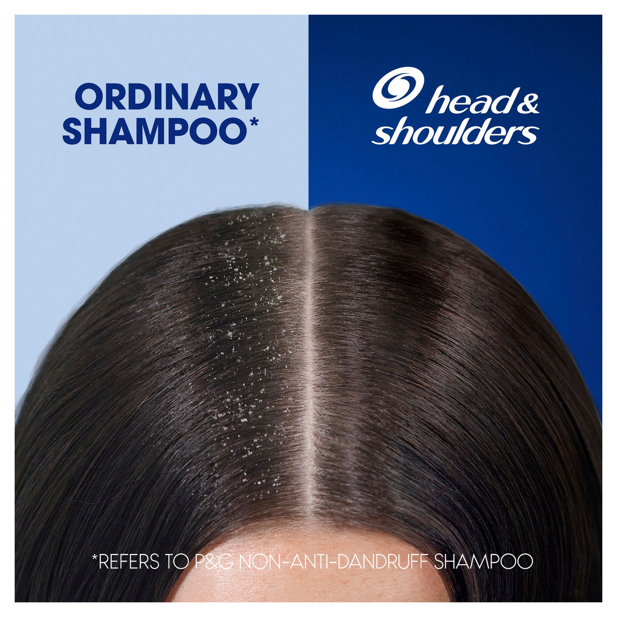 Head & Shoulders Ultramen 2in1 Old Spice Anti Dandruff Shampoo 750ml