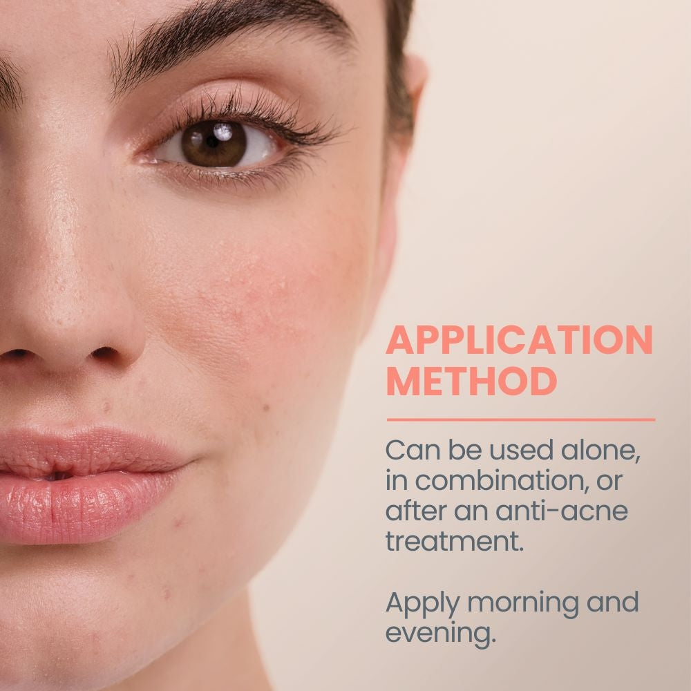 AVENE Cleanance Comedomed Conc 30ml