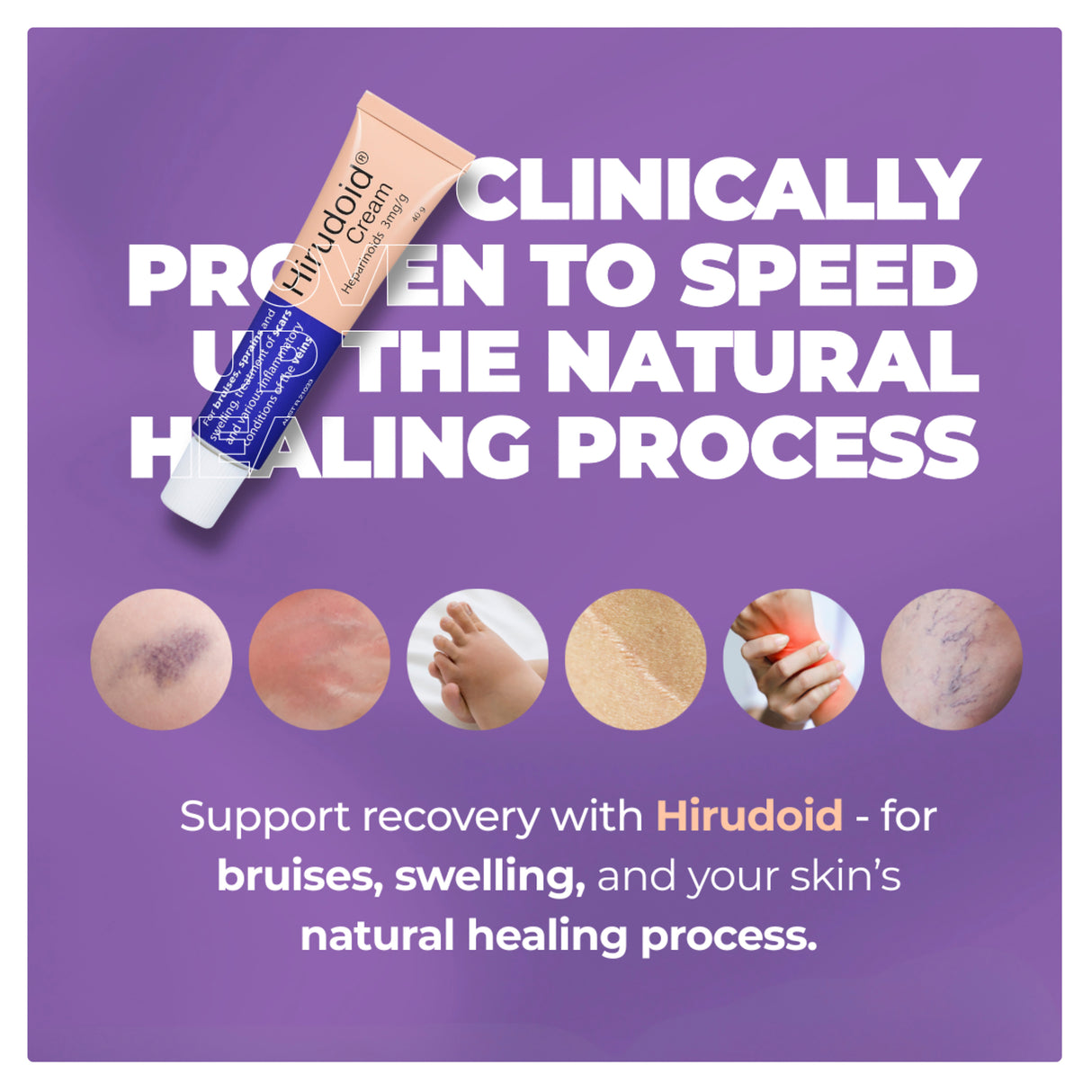 Hirudoid Cream 40g