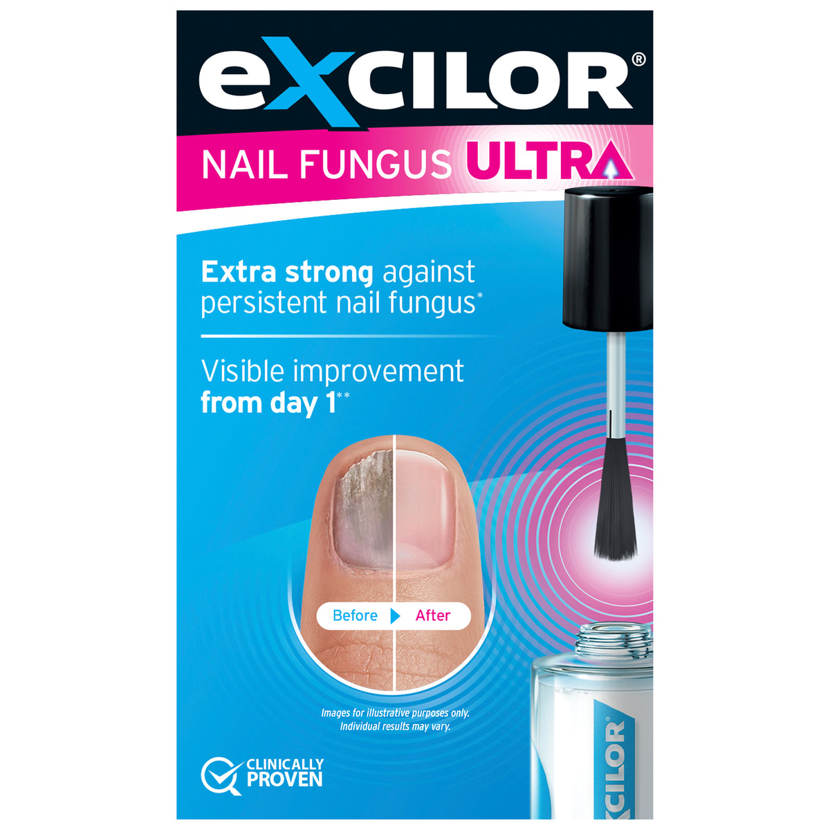 EXCILOR Ultra Nail Fungal Treat 30ml