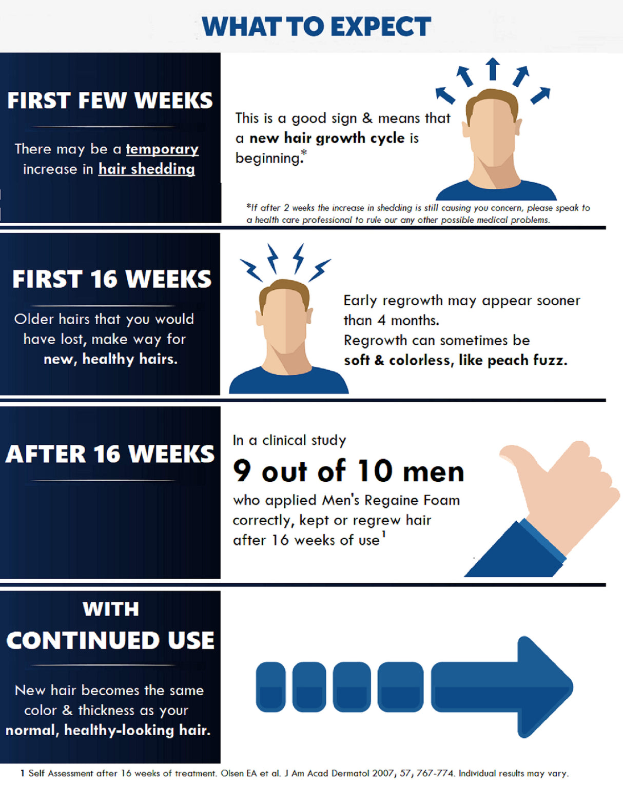 Regaine Men's Extra Strength Minoxidil Foam Hair Regrowth Treatment 60g