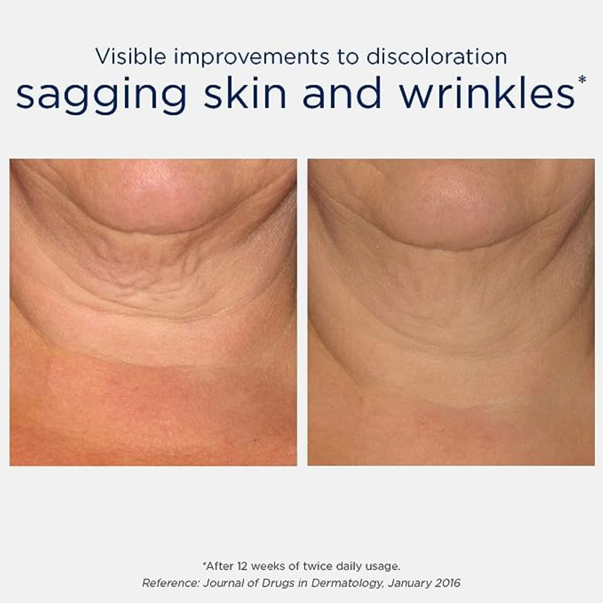 Neostrata Skin Active Triple Firming Neck Cream 80g