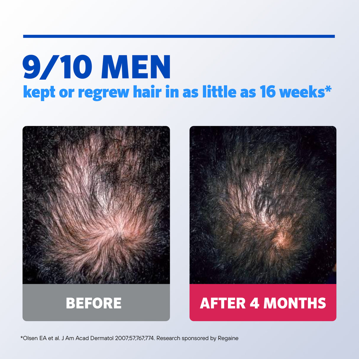 Regaine Men's Extra Strength Minoxidil Foam Hair Regrowth Treatment 60g