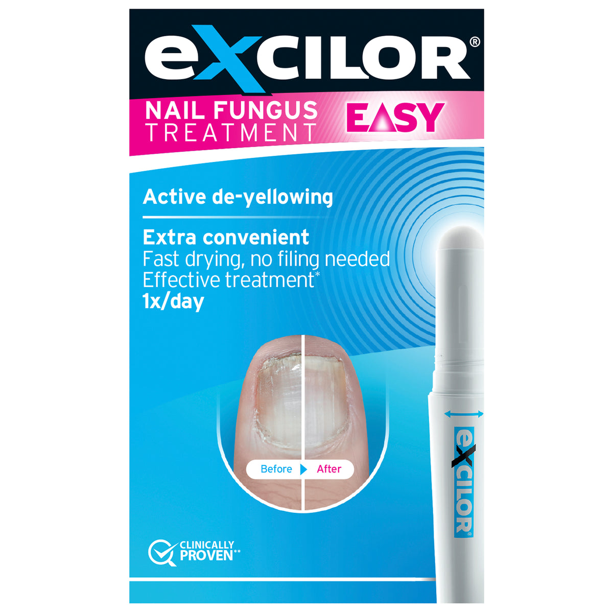 EXCILOR Nail Fungus Easy Pen 4ml
