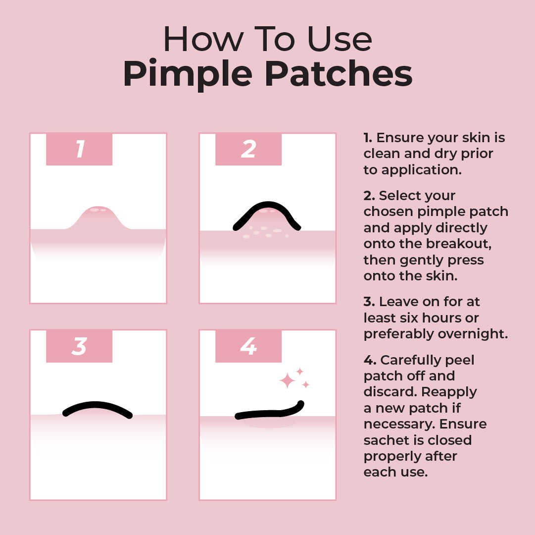 MCoBeauty Miracle Pimple Patches - 36pk