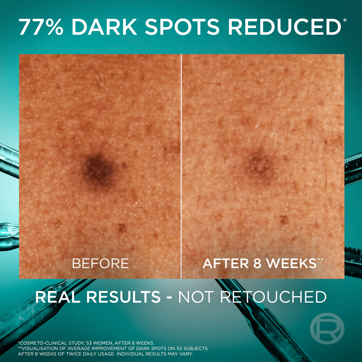 L'Oreal Bright Reveal Niacinamide Dark Spot Serum 30ml