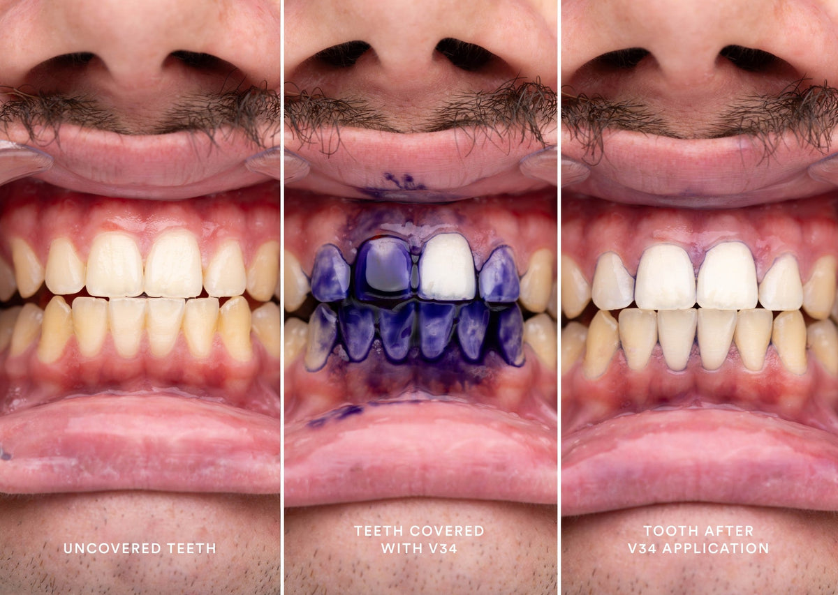 Hismile V34 Colour Correct Teeth Whitening Serum