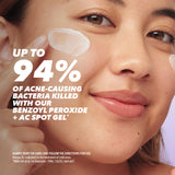 Benzac AC Treatment Gel 10% 60g