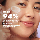 Benzac AC Treatment Gel 10% 60g