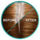 L'Oréal Paris Magic Retouch Temporary Root Concealer Spray - Golden Brown