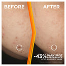 GARNIER Brightening Serum Vit C 30ml