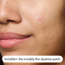 C&D Hero Mighty Patch Duo 12pcs