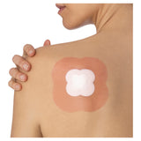 ALLEVYN LIFE Foam Dressing 10.3cm x 10.3cm 2/CS Pk