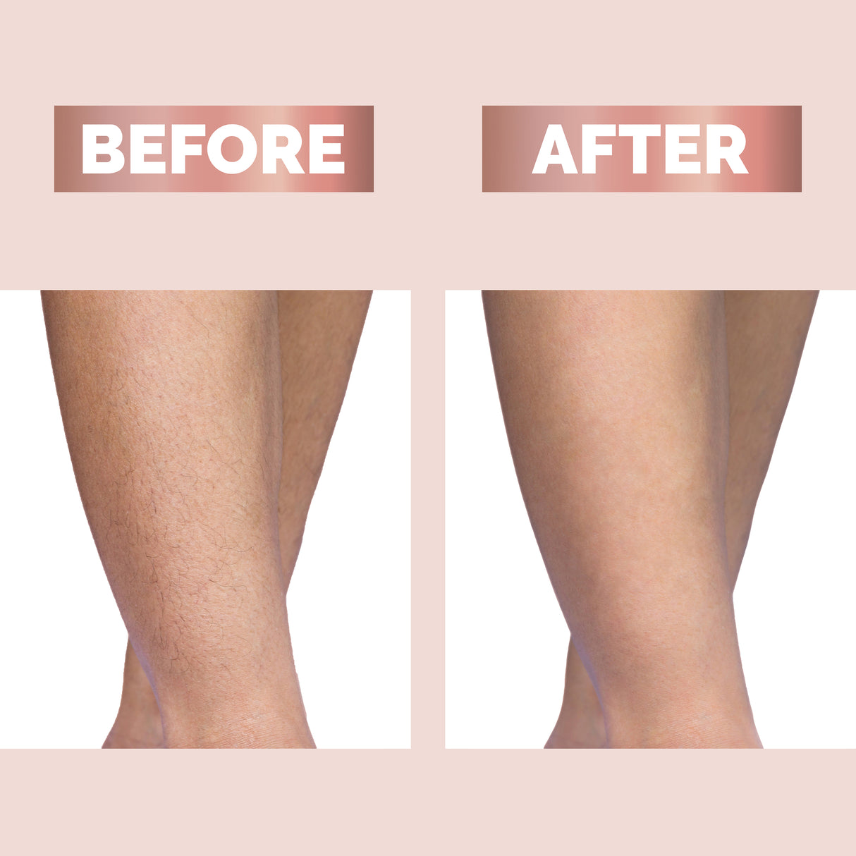 Finishing Touch Flawless Legs Gen2