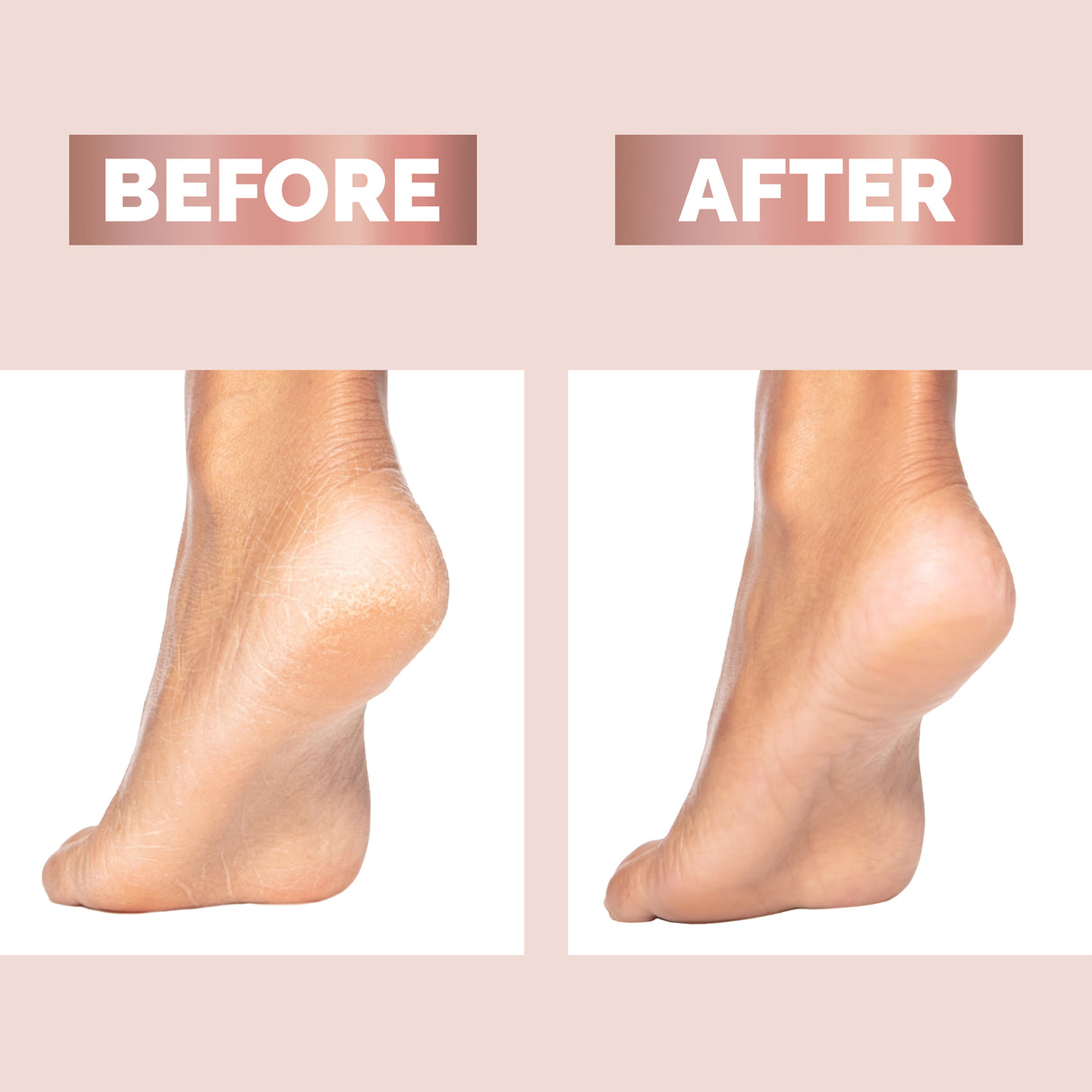 Finishing Touch Flawless Pedi Replacement Heads 3 Pack