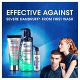 Head & Shoulders Advanced Itch Care Conditioner 200ml