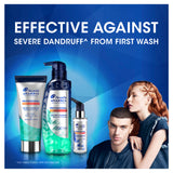Head & Shoulders Advanced Oil Control 300ml