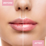 MCo MCH570 ON Lip Mask Van