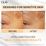 OLAY Luminous Vit C Sens Serum 30ml