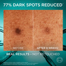 L'Oreal Bright Reveal Niacinamide Dark Spot Serum 30ml