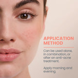 AVENE Cleanance Comedomed Conc 30ml