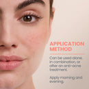 AVENE Cleanance Comedomed Conc 30ml