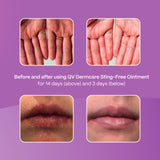 Ego QV Dermcare Sting-Free Ointment 100g