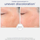 Neostrata Skin Active Fragrance Free Tri-Therapy Lifting Serum 30mL