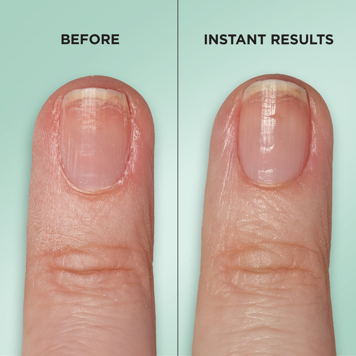Sally Hansen Gel Rehab Nail Repair Serum