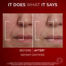 L'Oréal Paris Revitalift Laser X3 Anti-Ageing Day SPF 15 Cream 50ml