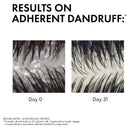 Vichy Dercos Anti-Dandruff Shampoo Oily Hair 200ml