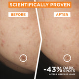 GARNIER Brightening Serum Vit C 30ml