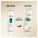 Pantene Pro-V Daily Moisture Renewal Shampoo: Moisturising Shampoo for Dry Hair 375 ml