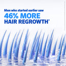 Regaine Men's Extra Strength Minoxidil Foam Hair Regrowth Treatment 60g