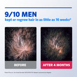 Regaine Men's Extra Strength Minoxidil Foam Hair Regrowth Treatment 60g