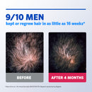 Regaine Men's Extra Strength Minoxidil Foam Hair Regrowth Treatment 60g
