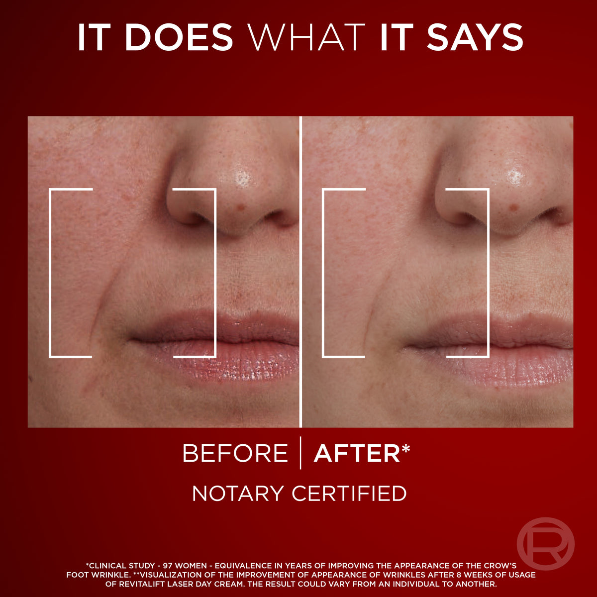 L'Oréal Paris Revitalift Laser X3 Day Cream 50ml