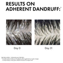 Vichy Dercos Anti-Dandruff Shampoo Dry Hair 200ml