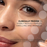 Skin Republic Spot Clear Patches 48s