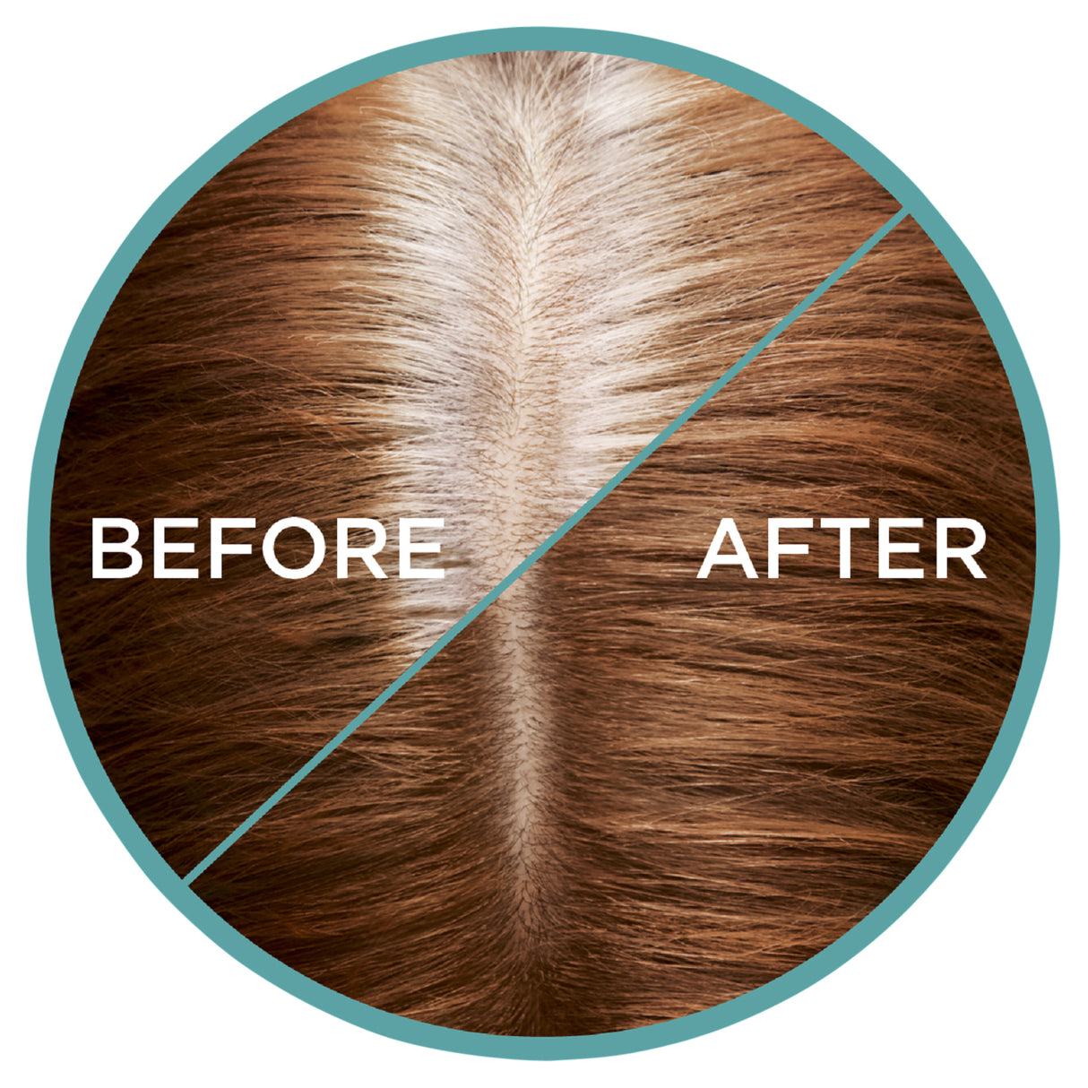 L'Oréal Paris Magic Retouch Temporary Root Concealer Spray - Auburn 6