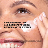 Skin Republic Alpha Arbutin 2% + Squalane 10% Overnight Mask 50ml